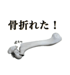 骨折だってさ（個別スタンプ：3）