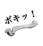 骨折だってさ（個別スタンプ：19）