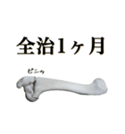 骨折だってさ（個別スタンプ：22）