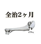 骨折だってさ（個別スタンプ：23）